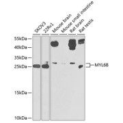 Western blot analysis of extracts of various cell lines using MYL6B Antibody (1/1000 dilution).