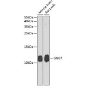 Western blot analysis of extracts of various cell lines using GNG7 Antibody (1/1000 dilution).