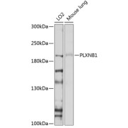 Western blot analysis of extracts of various cell lines using PLXNB1 Antibody (1/1000 dilution).