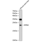 Western blot analysis of extracts of mouse pancreas using RPRM Antibody (1/1000 dilution).