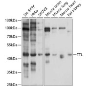Western blot analysis of extracts of various cell lines using TTL Antibody (1/1000 dilution).