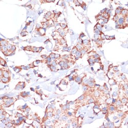 Ubiquitin-Conjugating Enzyme E2 O (UBE2O) Antibody
