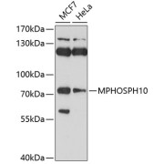 Western blot analysis of extracts of various cell lines using MPHOSPH10 Antibody (1/1000 dilution).