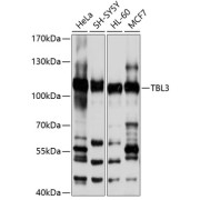 Western blot analysis of extracts of various cell lines using TBL3 Antibody (1/1000 dilution).
