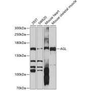 Western blot analysis of extracts of various cell lines using AGL Antibody (1/1000 dilution).