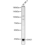 Western blot analysis of SK-BR-3 using DAG1 Antibody (1/1000 dilution).
