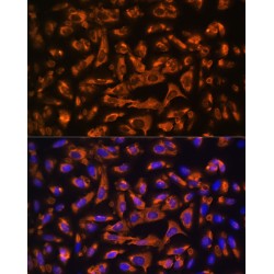 Dystroglycan (DAG1) Antibody