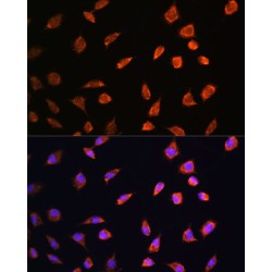 ADP Ribosyltransferase 1 (ART1) Antibody
