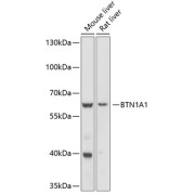 Western blot analysis of extracts of various cell lines using BTN1A1 Antibody (1/1000 dilution).
