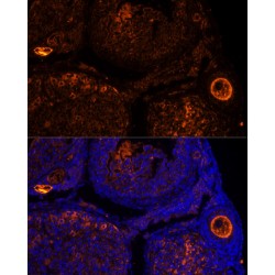 Zona Pellucida Glycoprotein 2 (ZP2) Antibody