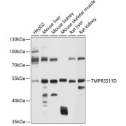 Western blot analysis of extracts of various cell lines using TMPRSS11D Antibody (1/1000 dilution).