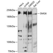 Western blot analysis of extracts of various cell lines using SMG6 Antibody (1/1000 dilution).