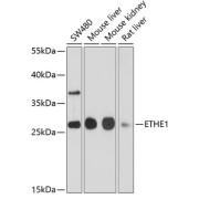 Western blot analysis of extracts of various cell lines using ETHE1 Antibody (1/1000 dilution).