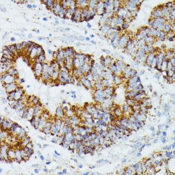 Ethylmalonic Encephalopathy 1 (ETHE1) Antibody