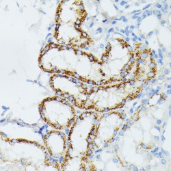 Ethylmalonic Encephalopathy 1 (ETHE1) Antibody