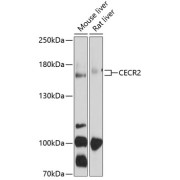 Western blot analysis of extracts of various cell lines using CECR2 Antibody (1/1000 dilution).
