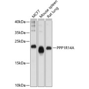 Western blot analysis of extracts of various cell lines using PPP1R14A Antibody (1/1000 dilution).