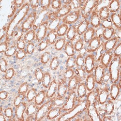 Chromosome-Associated Kinesin KIF4A (KIF4A) Antibody
