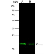 Western blot analysis of recombinant EBOV (subtype Zaire, strain H.sapiens-wt/GIN/2014/Kissidougou-C15) Matrix protein VP40 Protein (50 ng and 20 ng), using EBOV (subtype Zaire, strain H.sapiens-wt/GIN/2014/Kissidougou-C15) Nucleoprotein Antibody (1/1000 dilution).