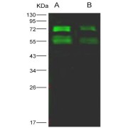 Western blot analysis of recombinant MERS-CoV Spike Protein (S2 Subunit, 726-1296 AA) (200 ng and 50 ng), using MERS-CoV Spike Protein S2 Antibody (1/1000 dilution).