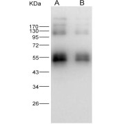 Western blot analysis of recombinant ZIKV (strain Zika SPH2015) NS1 protein (30 ng and 10 ng), using ZIKV-NS1 Antibody (1/1000 dilution).