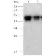 Western blot analysis of recombinant SARS-CoV Nucleoprotein (30 ng and 5 ng), using SARS-CoV Nucleoprotein Antibody (1/2000 dilution).