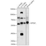 Western blot analysis of extracts of various cell lines using MTPAP Antibody (1/1000 dilution).
