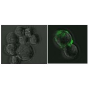 IF analysis of 293T cells (left) and 293T cells overexpressing SARS-CoV-2 Spike Protein (right), using SARS-CoV-2 Spike Protein Antibody (1/50 dilution).