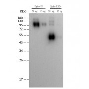 WB analysis of SARS-CoV-2 (1) Spike 1 protein, and (2) Spike RBD protein, using SARS-CoV-2 Spike RBD Protein Antibody (1/2000 dilution).