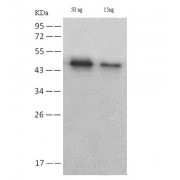 WB analysis of SARS-CoV-2 nucleoprotein, using SARS-CoV-2 NP Antibody (1/1000 dilution).