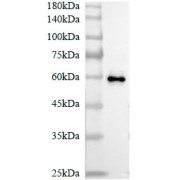 Western blot analysis of pseudovirion using SARS-CoV-2 NSP13 antibody(SARS-CoV-2) (1/1000 dilution).