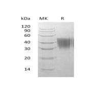 SDS-PAGE analysis of recombinant Human Alpha-1-Acid Glycoprotein 2 (ORM2) Protein.