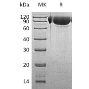 SDS-PAGE analysis of recombinant N-Acetylglucosamine-6-Sulfatase (GNS) Protein.
