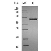SDS-PAGE analysis of recombinant Pancreatic Lipase-Related Protein 1 (PLRP1) Protein.