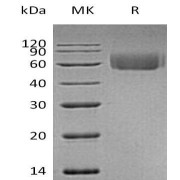 SDS-PAGE analysis of recombinant Human Interleukin 1 Receptor Like Protein 2 (IL1RL2) Protein.