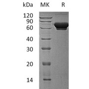 SDS-PAGE analysis of recombinant Mannosidase Alpha Class 1B Member 1 Protein.