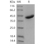 SDS-PAGE analysis of recombinant Human RSPO1 Protein.