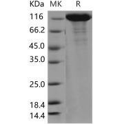 SDS-PAGE analysis of recombinant Vinculin (VCL) Protein.