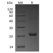 SDS-Page analysis of recombinant Human NHP2 protein.