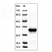Human Caspase-14 (CASP14) Protein (Active)