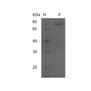 SDS-PAGE analysis of recombinant Human Coagulation Factor XIII B Chain (F13B) Protein.