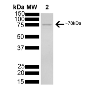 SDS-PAGE analysis of recombinant Human Endoplasmic Reticulum Chaperone BiP (HSPA5) Protein (Active).