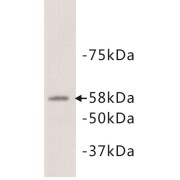 abx019007