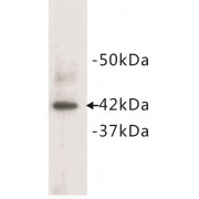 Western blot analysis of mouse heart tissue lysate, using alpha Actin (Cardiac actin) antibody.