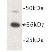 abx019017