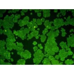 Apoptosis Regulator Bcl-2 (BCL2) Antibody