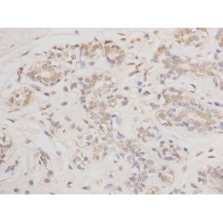 Apoptosis Regulator Bcl-2 (BCL2) Antibody