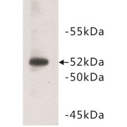 abx019020