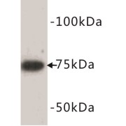 Bone Morphogenetic Protein 2 (BMP2) Antibody