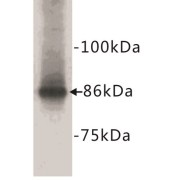 Catenin Beta (CTNNB1) Antibody